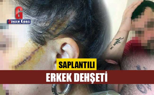 Saplantılı erkek dehşeti: Dövüp yüzünü usturayla kesti
