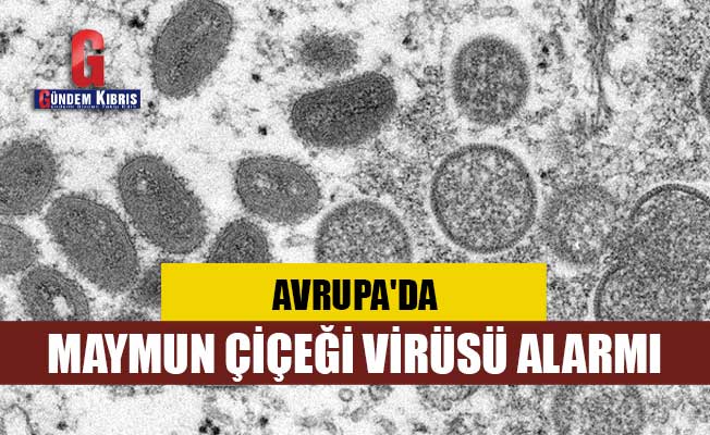 Avrupa'da maymun çiçeği virüsü alarmı