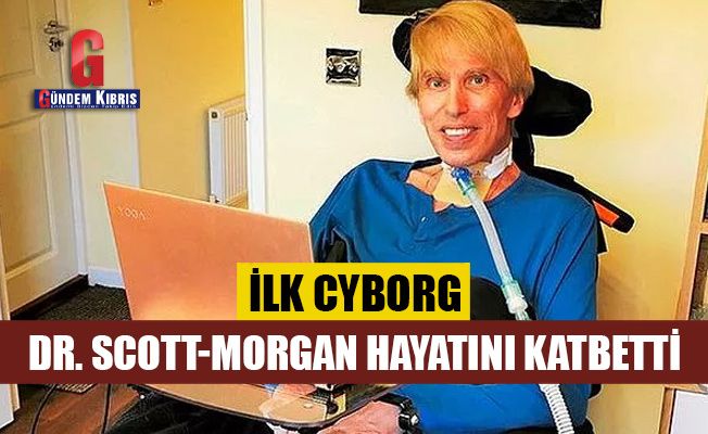 İlk cyborg, Dr. Scott-Morgan hayatını kaybetti