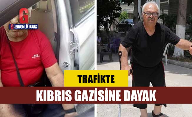 Otobüs şoförü, trafikte tartıştığı engelli Kıbrıs gazisini dövdü